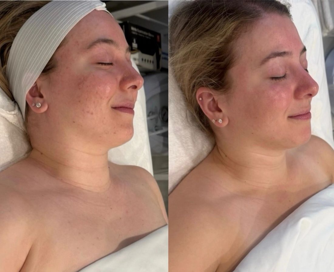 Facials at Artigo Facial Spa